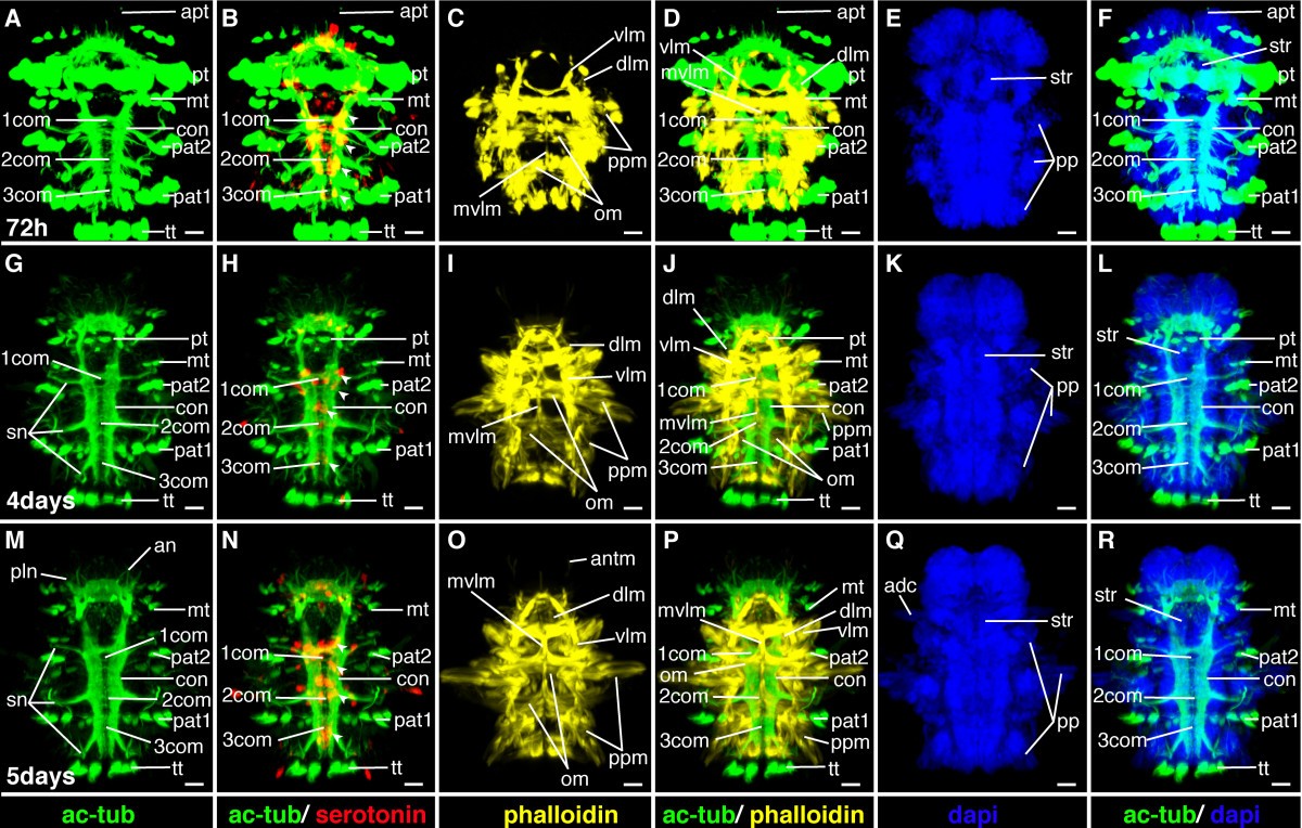 Figure 23