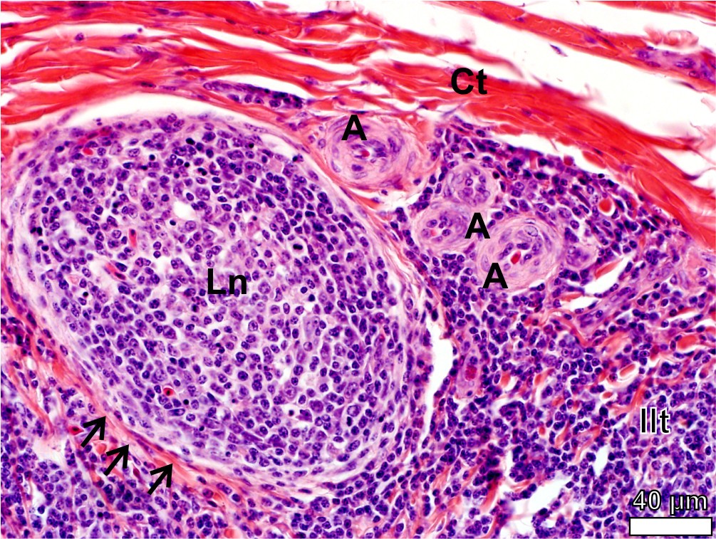 Figure 13