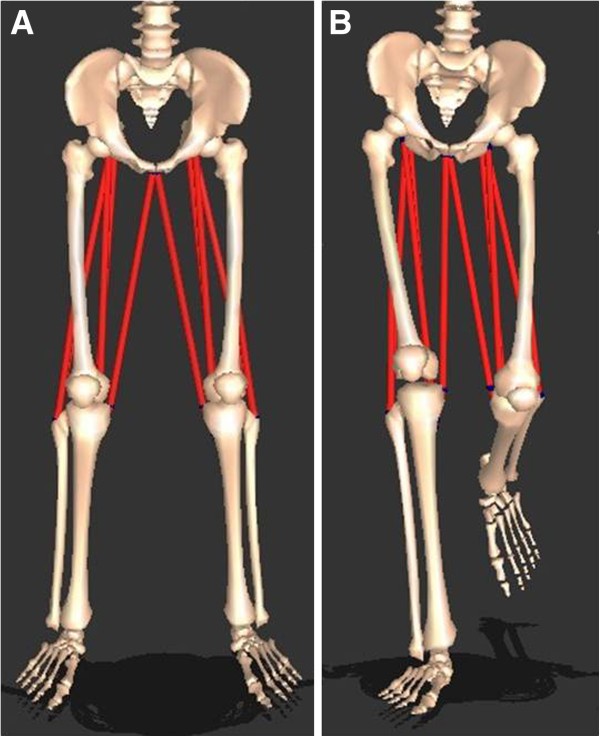 Hamstring And Psoas Length Of Crouch Gait In Cerebral