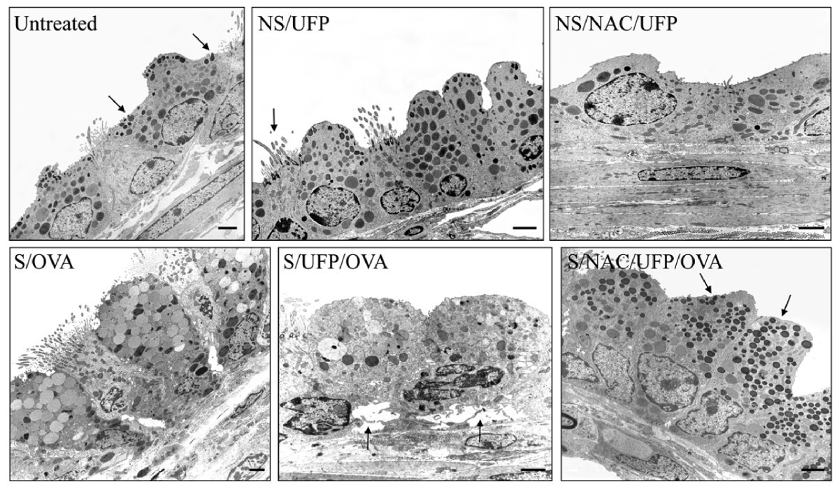 Effects of ultrafine particles-induced oxidative stress on Clara cells in  allergic lung inflammation | Particle and Fibre Toxicology | Full Text