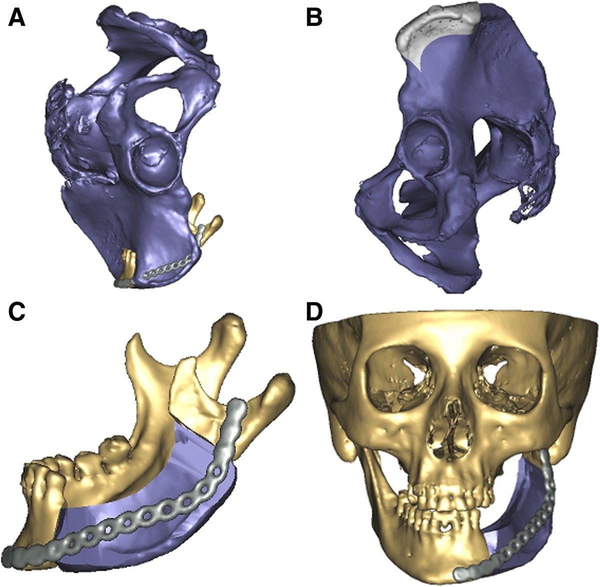 Figure 4