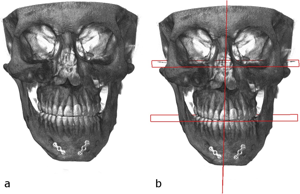 Figure 16