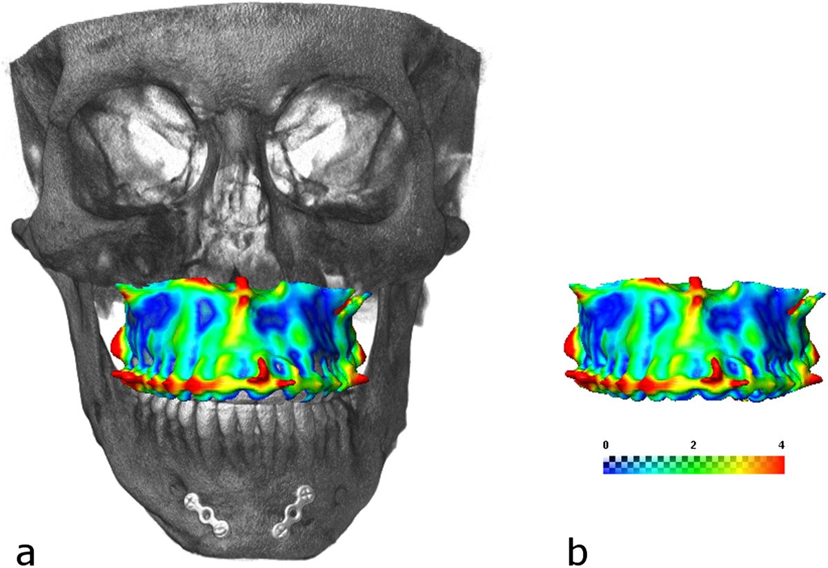 Figure 17