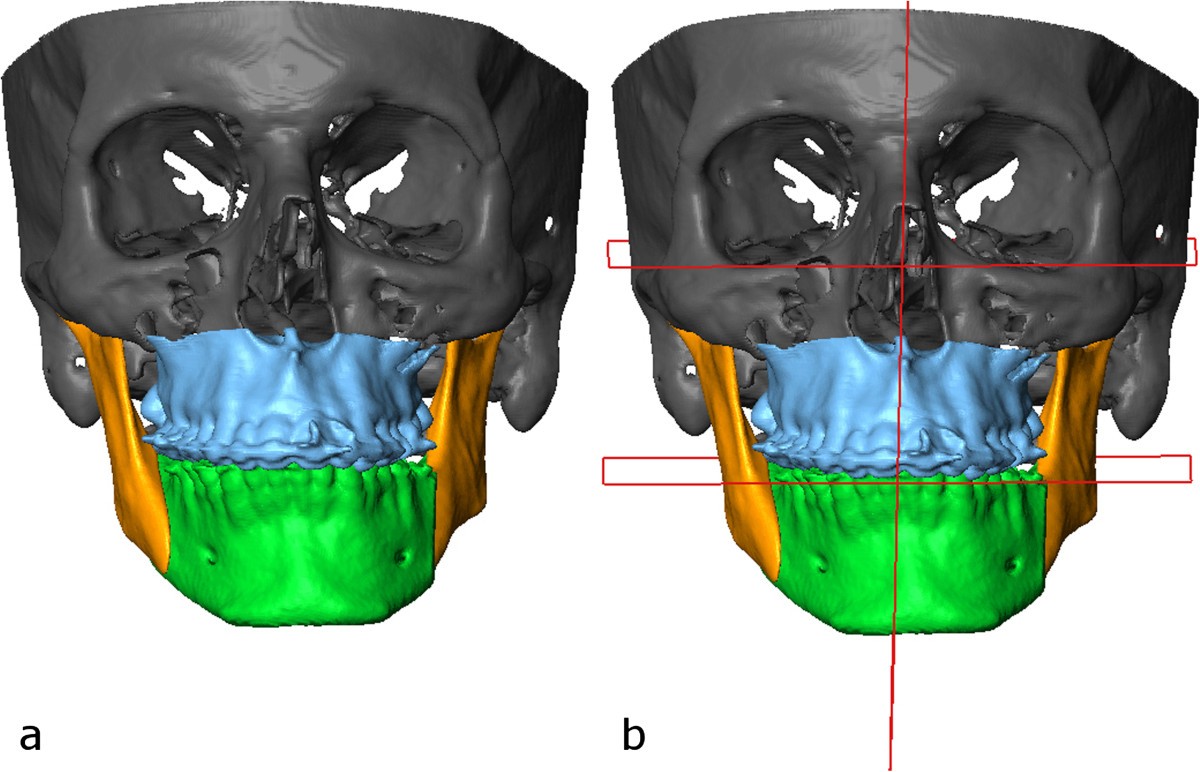 Figure 9