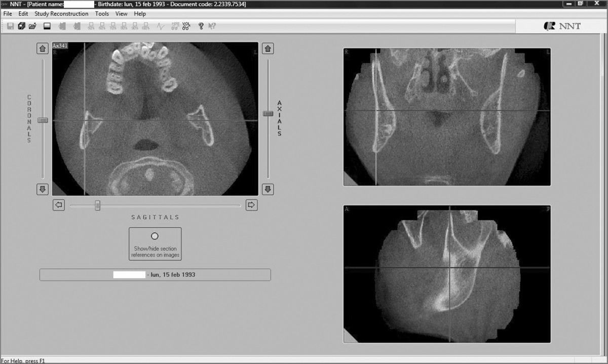 Figure 17