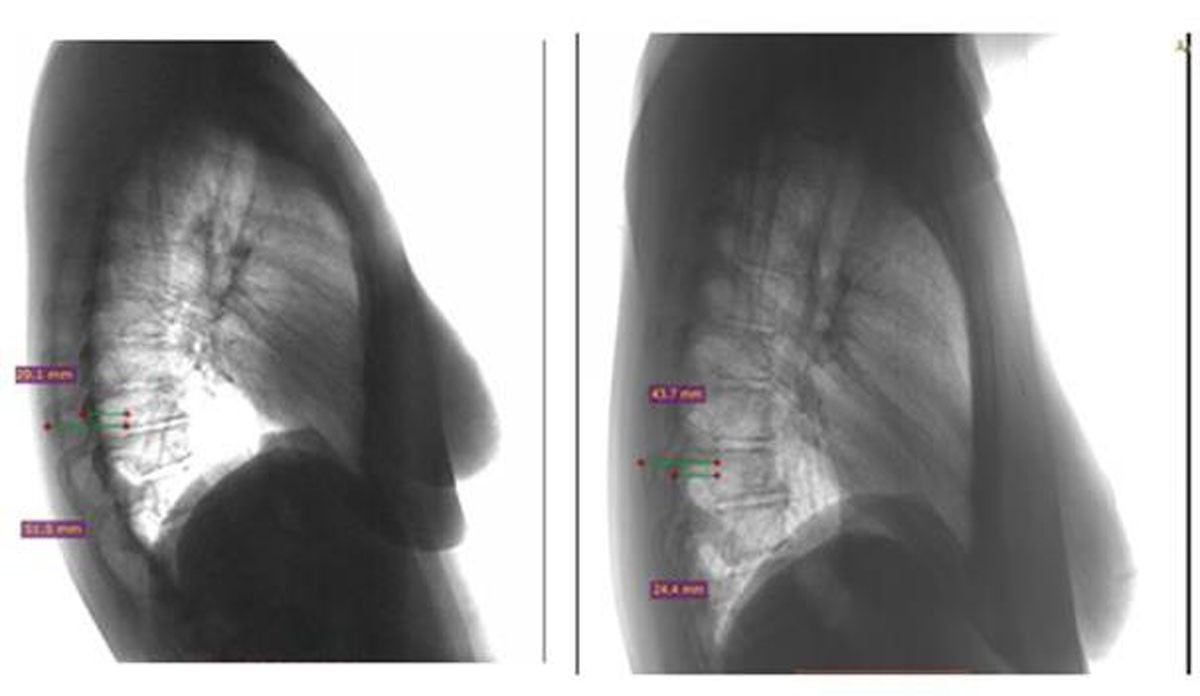 Figure1