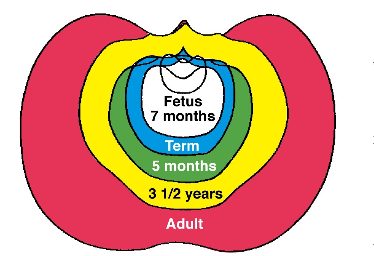 Figure 10