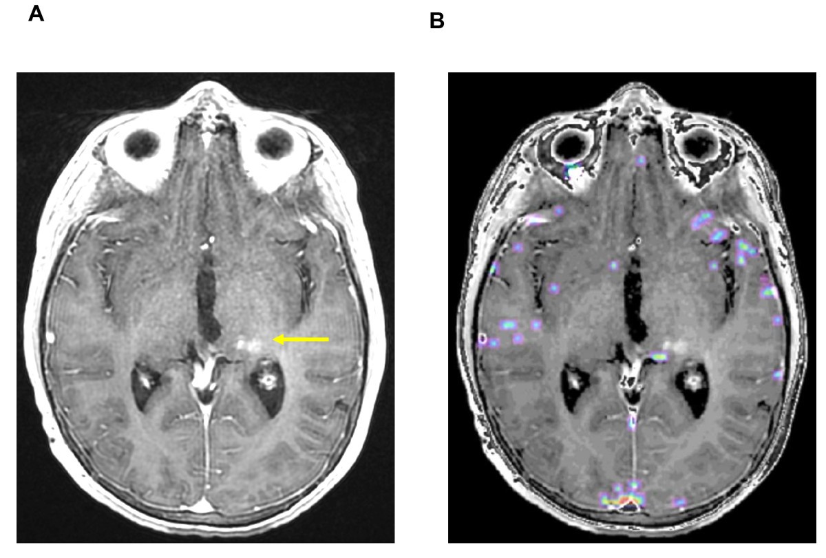 Figure 4