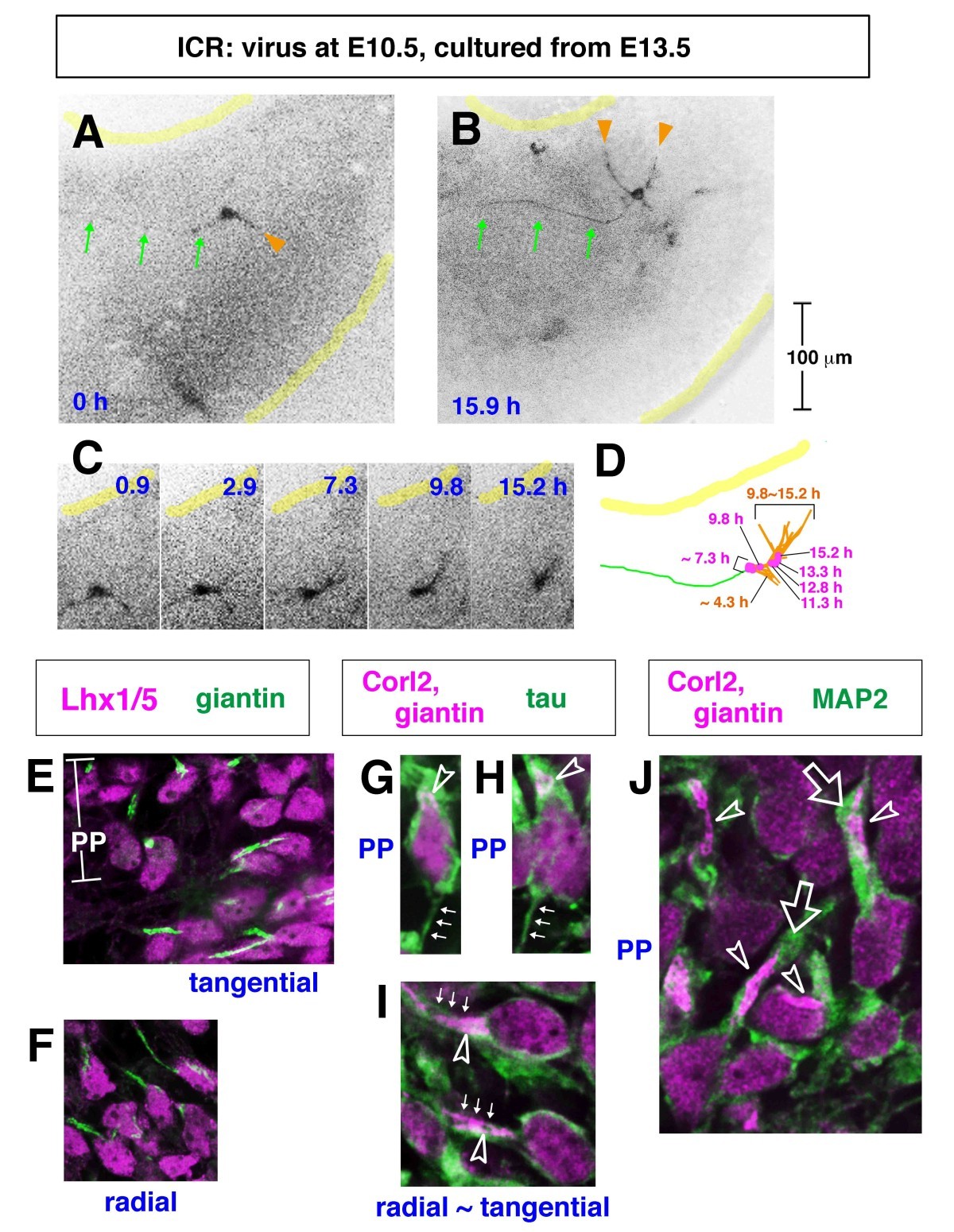 Figure 11