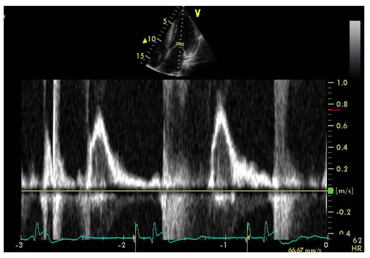 Figure 12