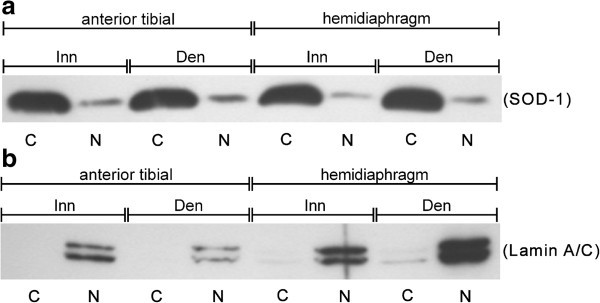 p38 mitogen-activated protein kinase and mitogen-activated protein  kinase-activated protein kinase 2 (MK2) signaling in atrophic and  hypertrophic denervated mouse skeletal muscle | Journal of Molecular  Signaling | Full Text