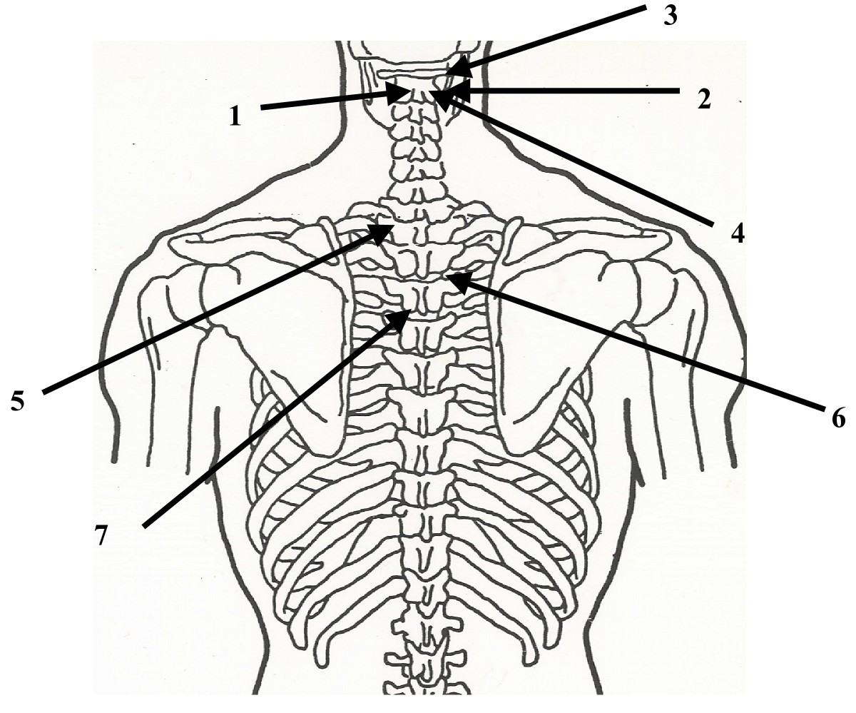 Figure 22