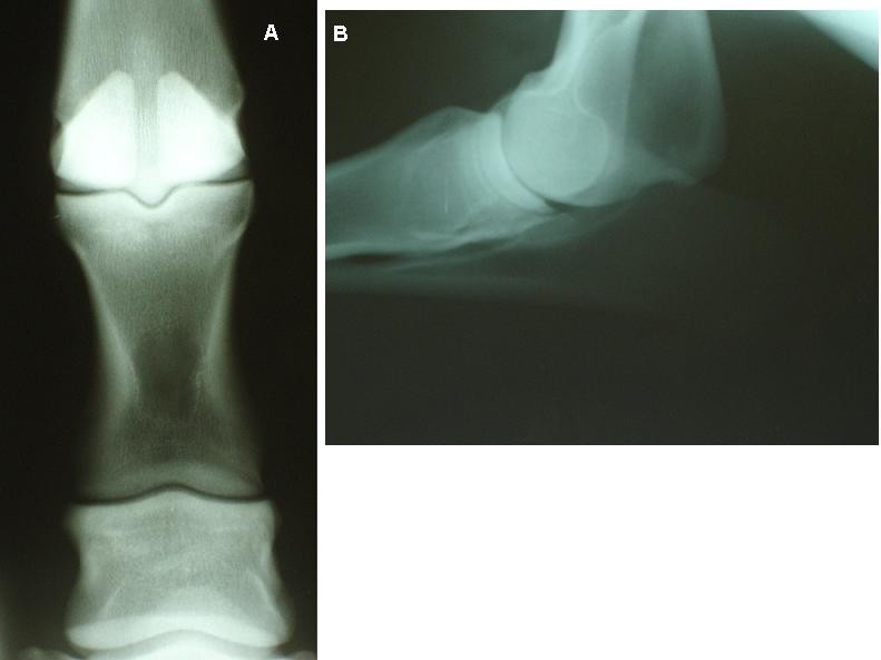 Radiographic closure time of appendicular growth plates in the Icelandic  horse | Acta Veterinaria Scandinavica | Full Text