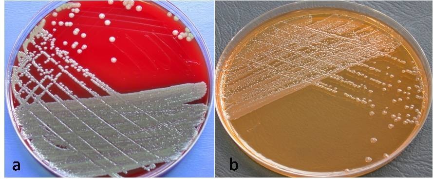 Посев на сальмонеллез. Elizabethkingia meningoseptica микробиология. Посев Shigella SPP., Salmonella SPP.. Вейлонеллы микробиология. Посев на возбудителей кишечной группы (Shigella SPP., Salmonella SPP.).