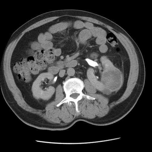 ct contrast white papers on effects of kidney
