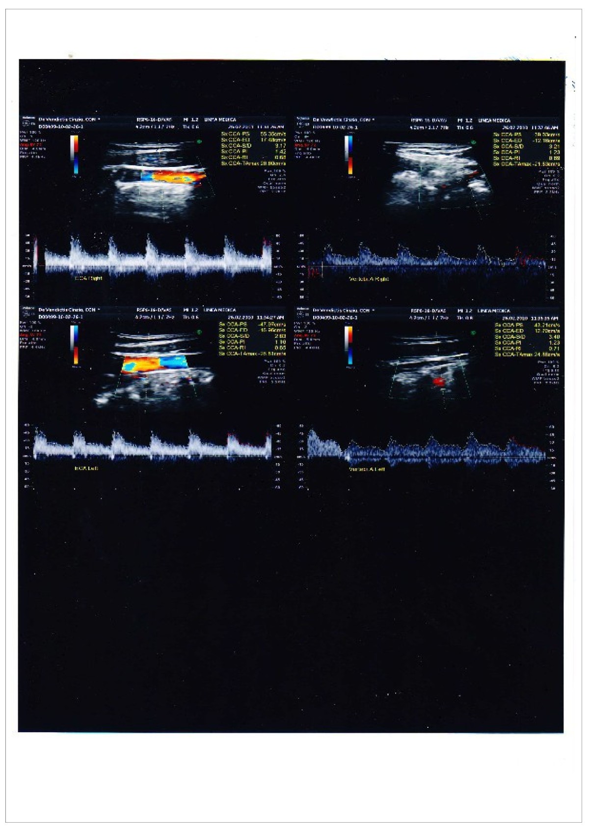 Figure 11