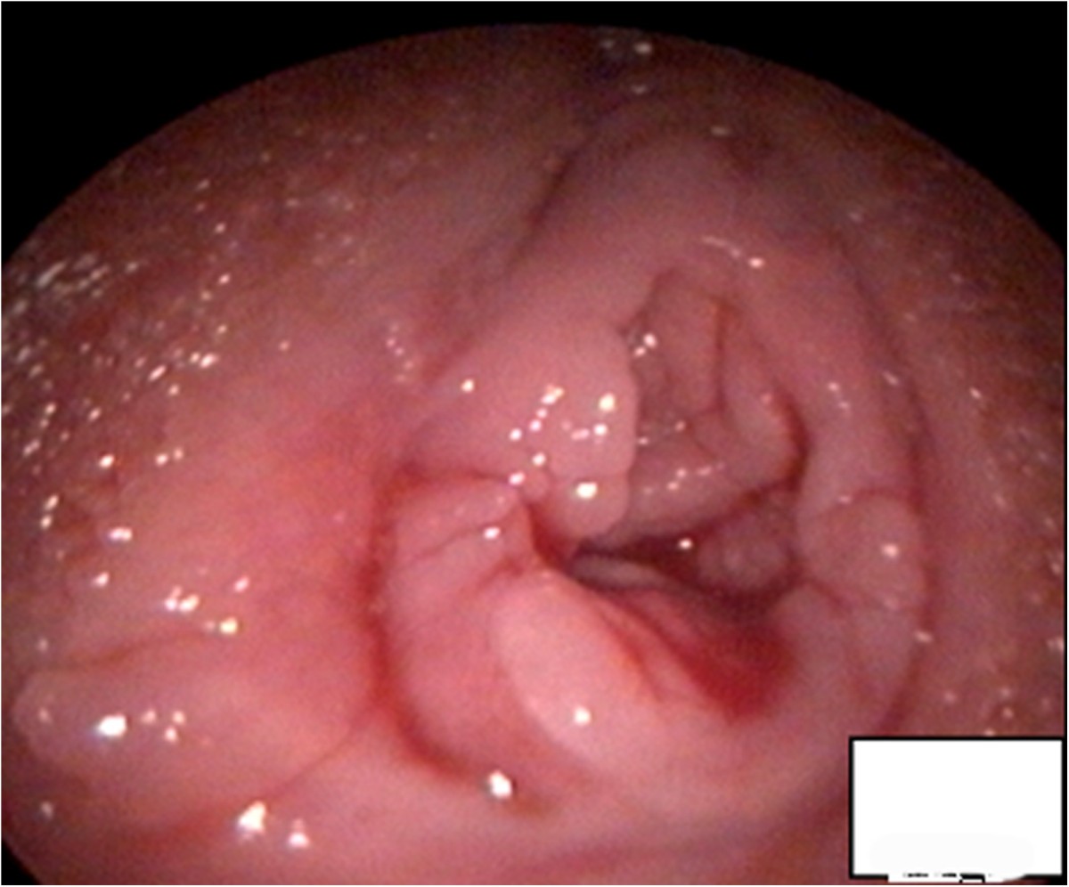 Figure 1. A photo showing that the hymen of the patient was not damaged aft...