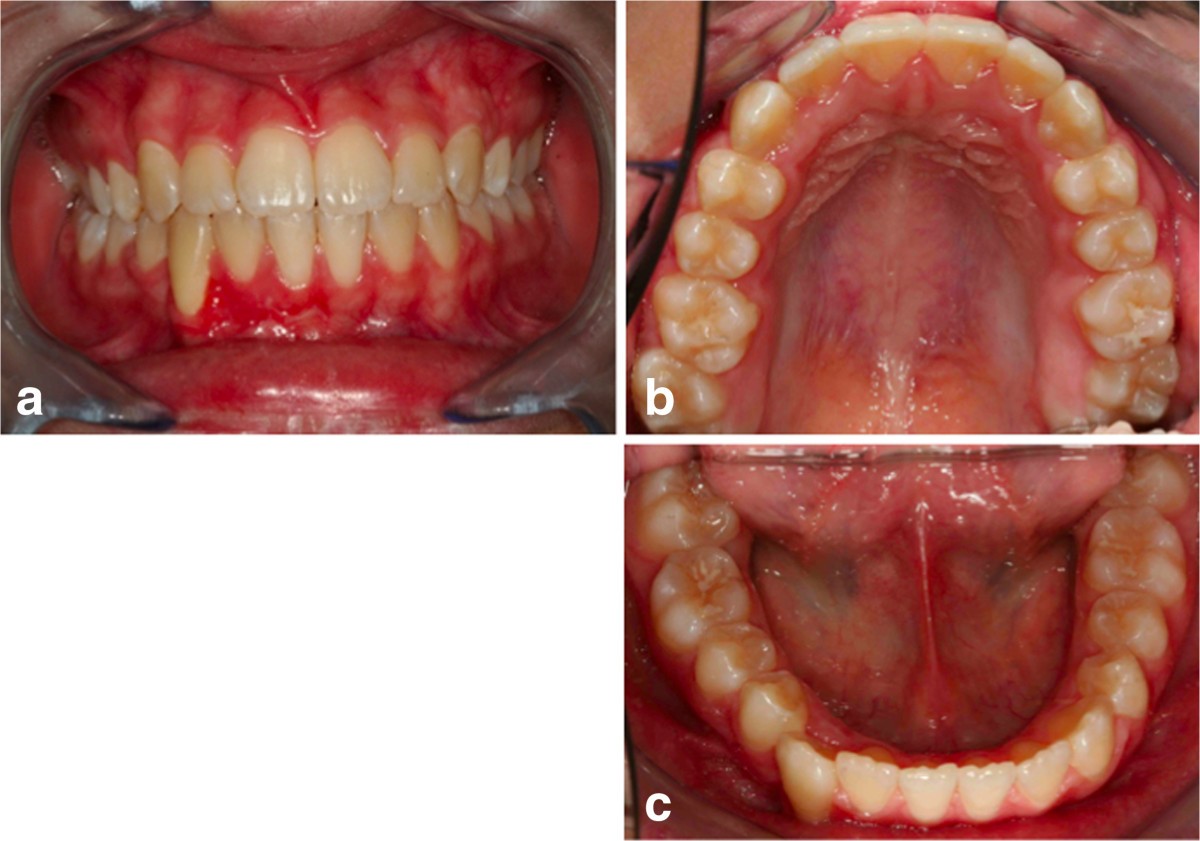 Figure 16