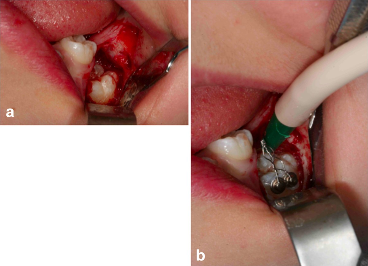 Figure 21