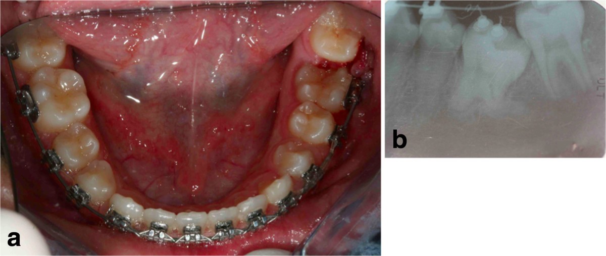 Figure 25