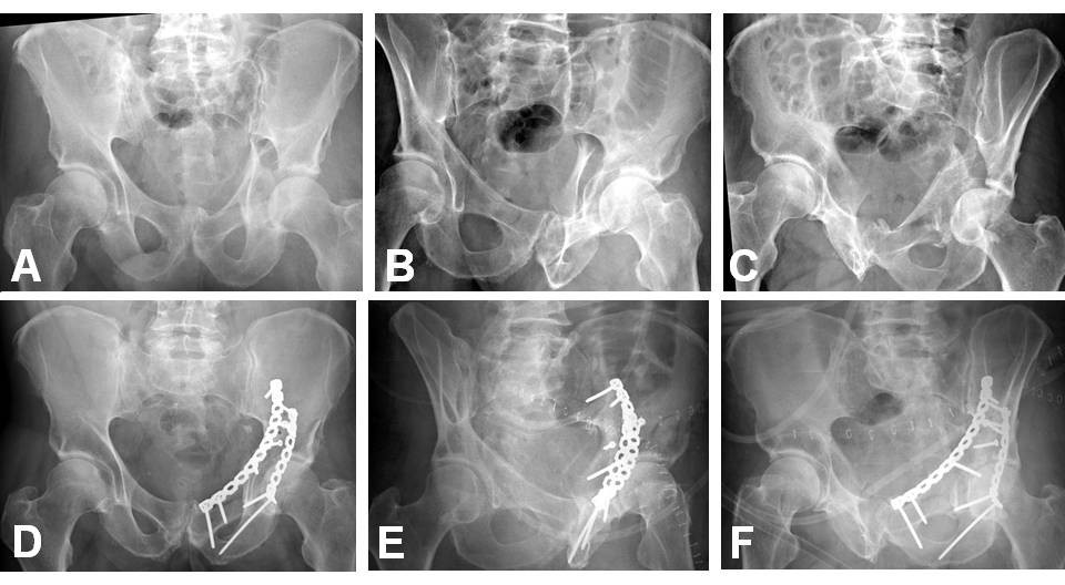 Figure 13