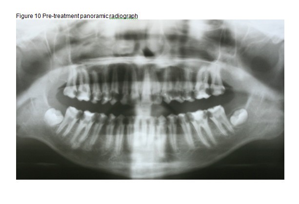 Figure 10