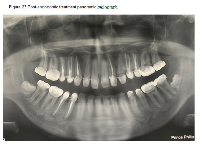 Figure 23