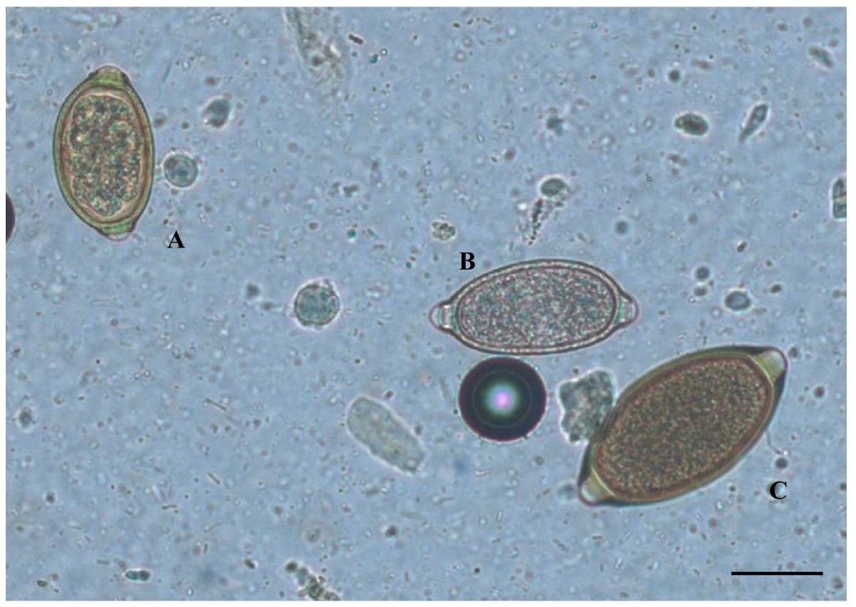 Mixed trichuroid infestation in a dog from Italy | Parasites & Vectors |  Full Text