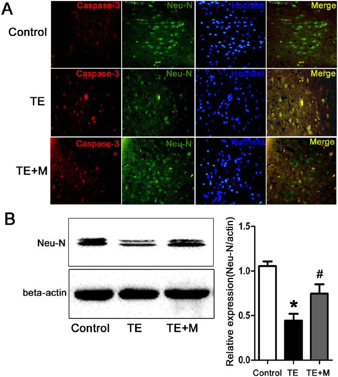 Activated microglia contribute to neuronal apoptosis in Toxoplasmic  encephalitis | Parasites & Vectors | Full Text
