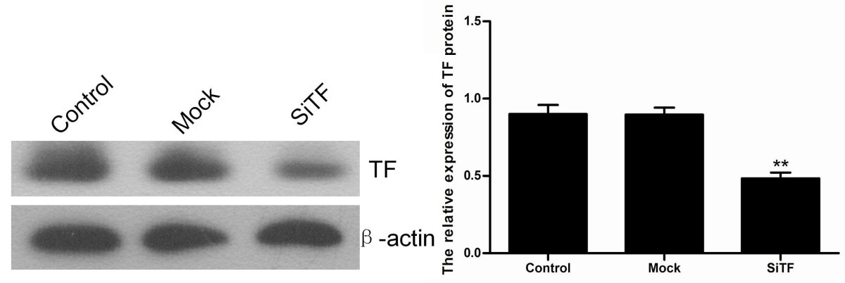 Figure 20