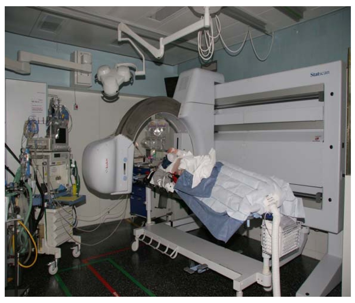 Personal experience with wholebody, lowdosage, digital Xray scanning