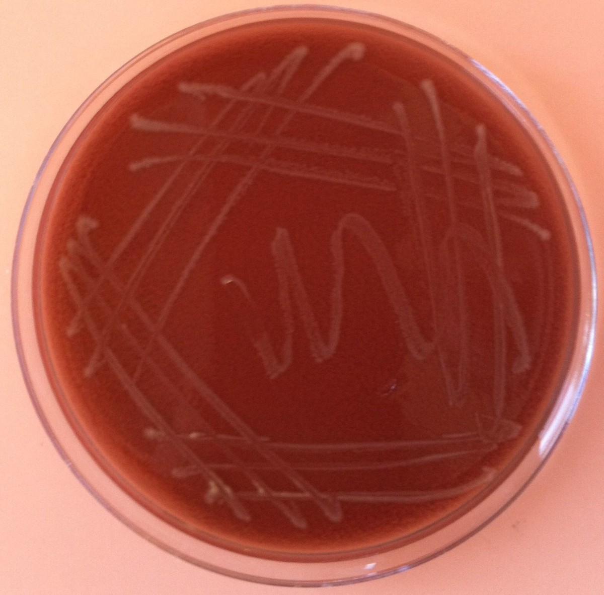 Haemophilus influenzae 10