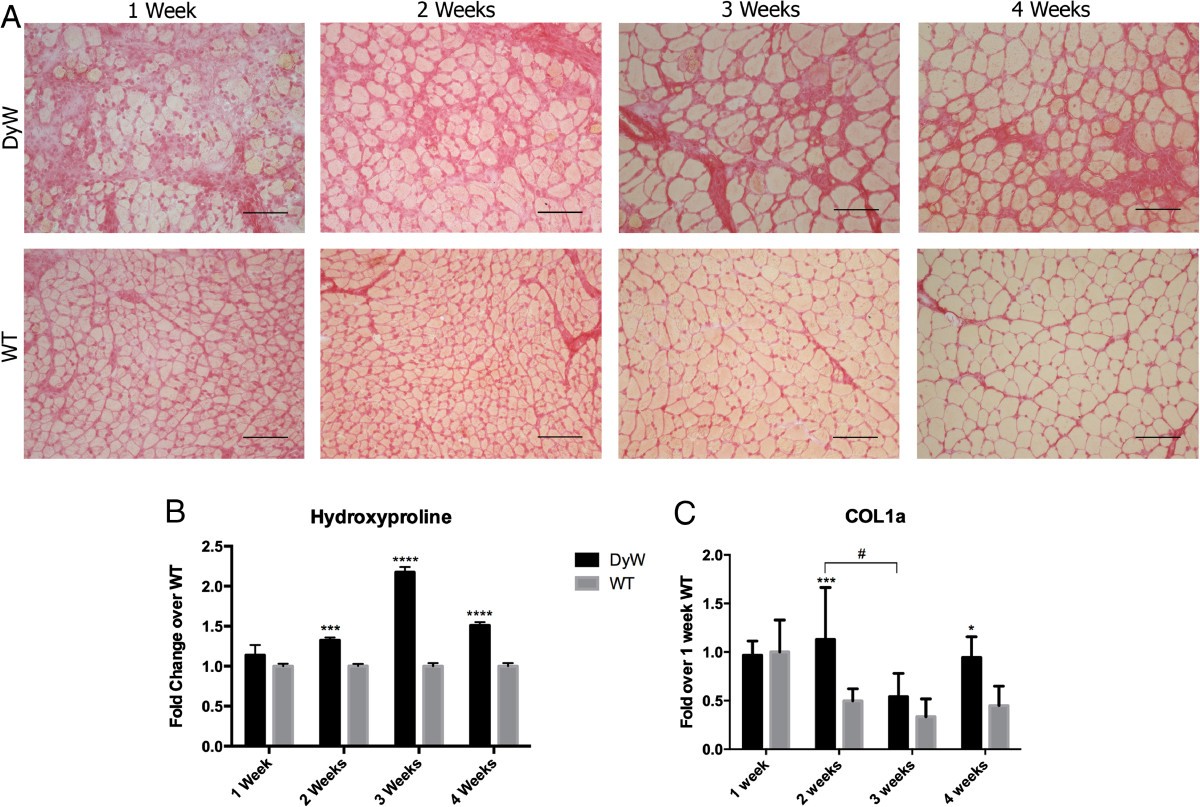 nabo Periodisk Globus Dysregulation of matricellular proteins is an early signature of pathology  in laminin-deficient muscular dystrophy | Skeletal Muscle | Full Text