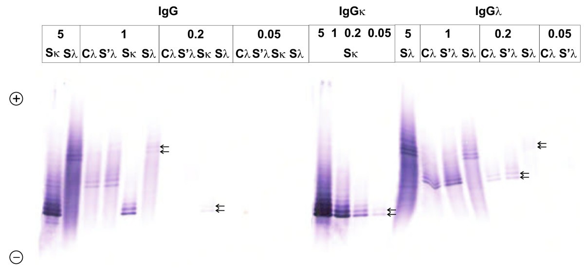 Soms soms schoner Oppervlakte Detection of oligoclonal IgG kappa and IgG lambda bands in cerebrospinal  fluid and serum with Hevylite™ antibodies. comparison with the free light  chain oligoclonal pattern | Fluids and Barriers of the CNS 