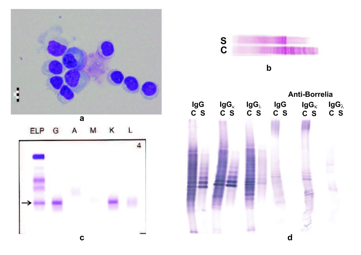 Detection of oligoclonal IgG kappa and IgG lambda bands in cerebrospinal  fluid and serum with Hevylite™ antibodies. comparison with the free light  chain oligoclonal pattern | Fluids and Barriers of the CNS