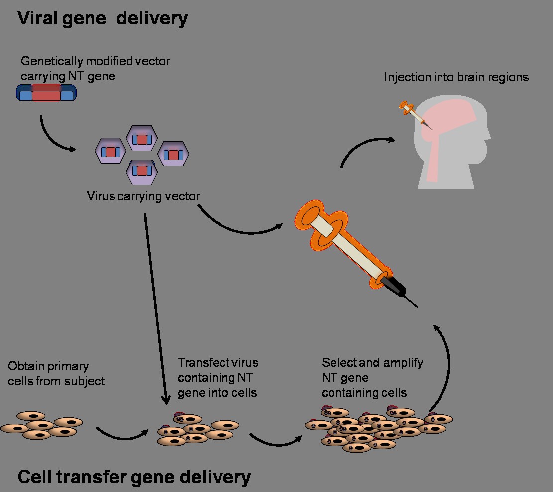 Direct viral gene delivery of neurotrophin (NT) gene occurs through inserti...