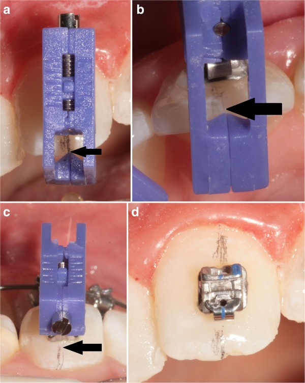 Figure 14