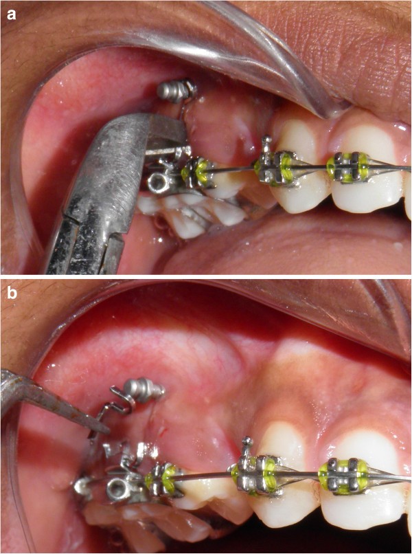 Figure 11