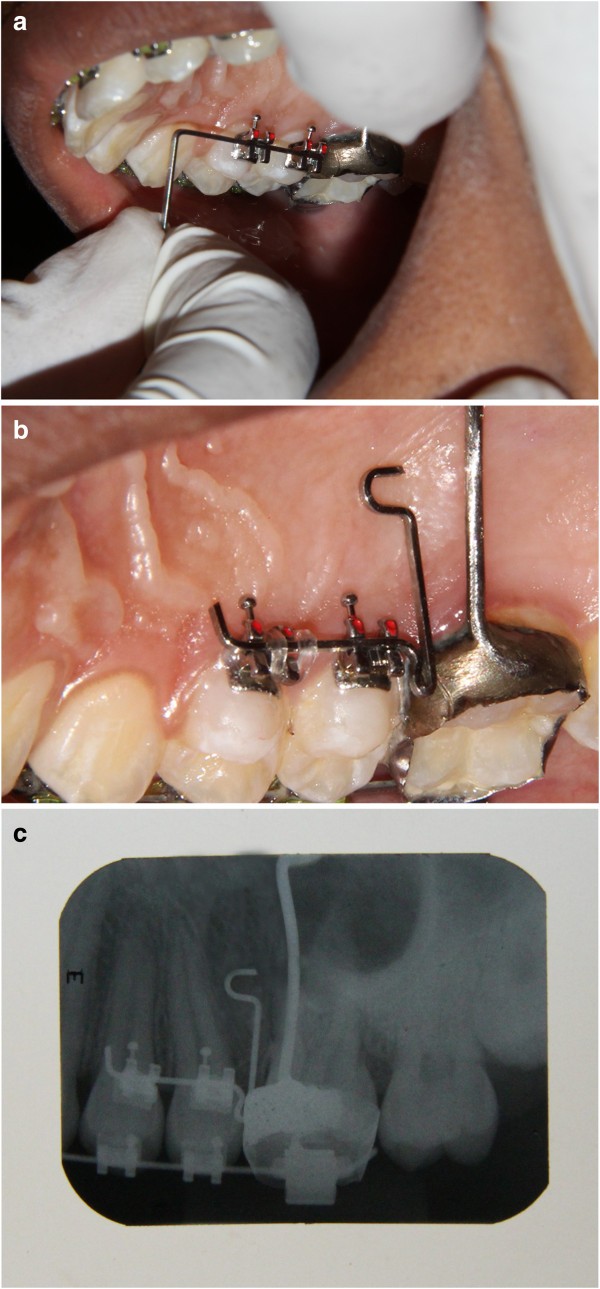 Figure 16