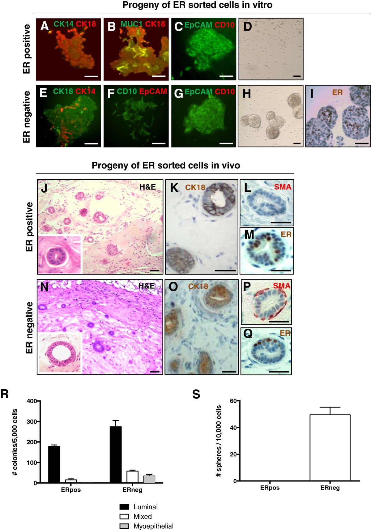 Aldehyde dehydrogenase and estrogen receptor define a hierarchy of cellular  differentiation in the normal human mammary epithelium | Breast Cancer  Research | Full Text