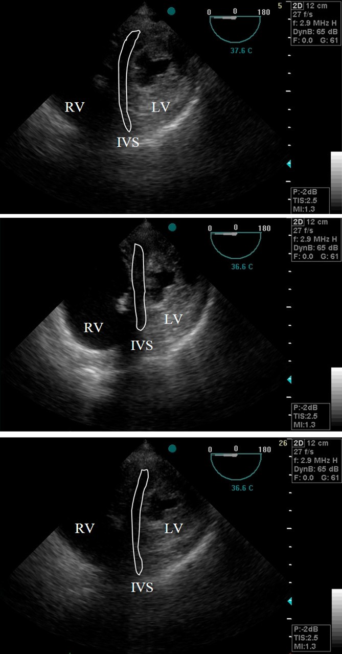 Figure 5