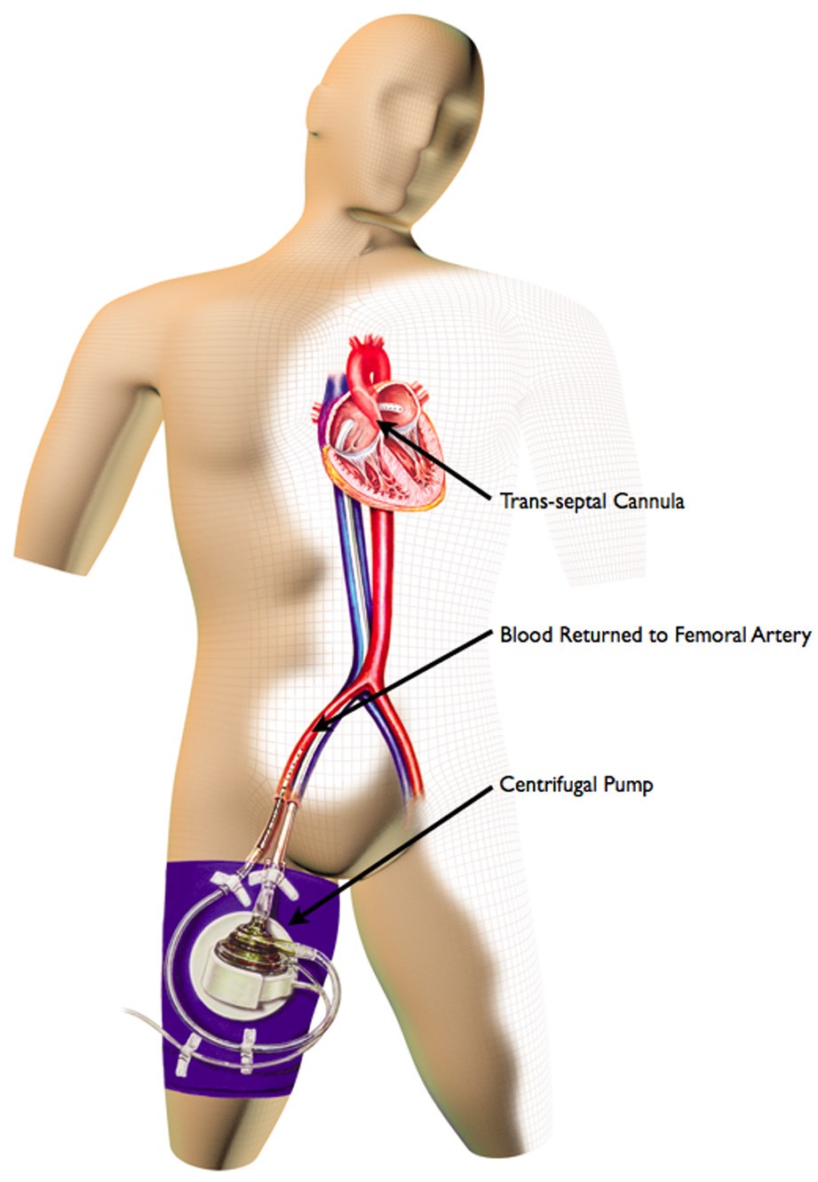 Figure 4