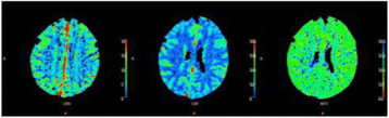 Fig. 1 (abstract P166).