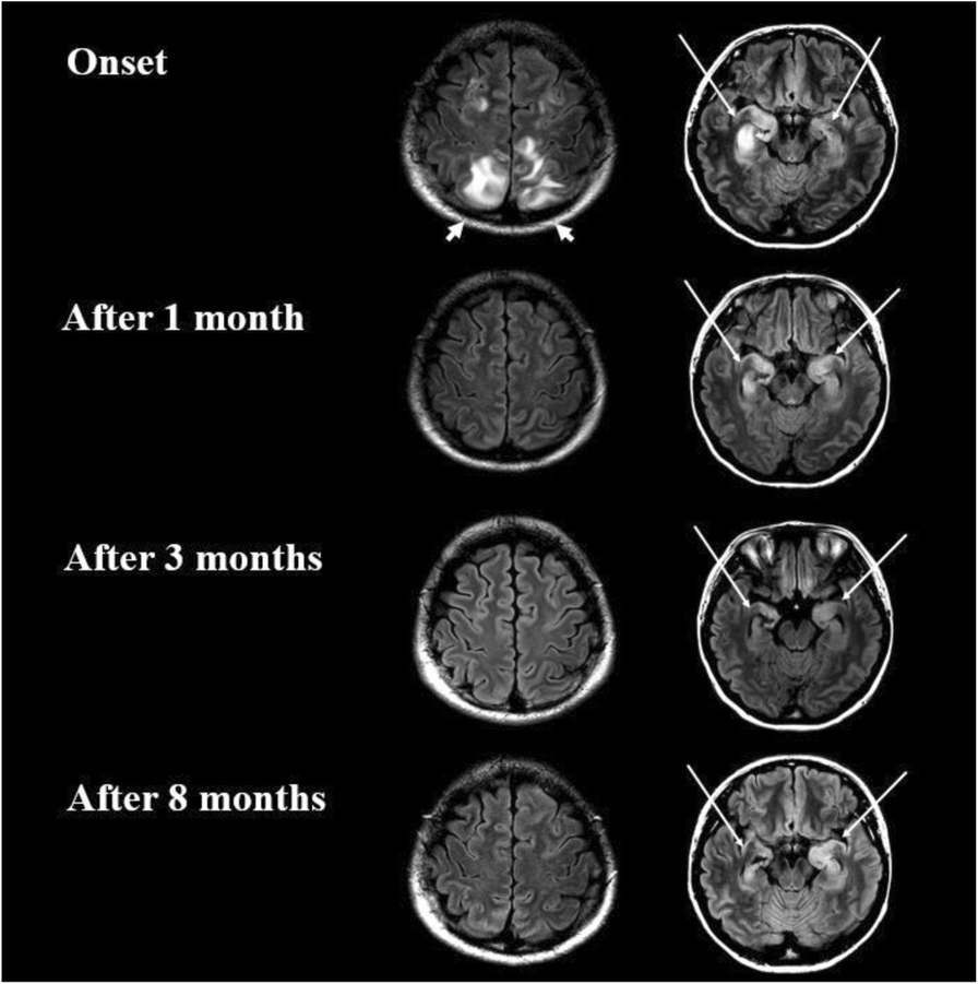 Fig. 1 (abstract P33).