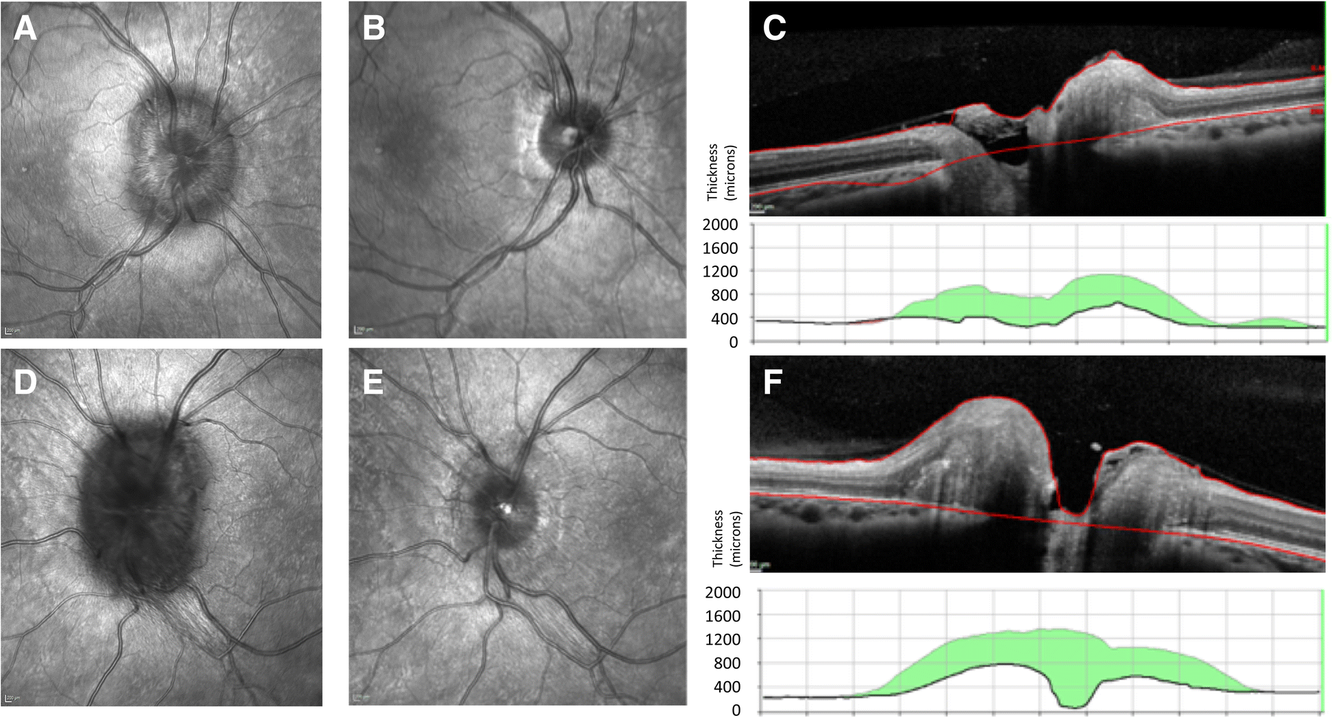 Fig. 4