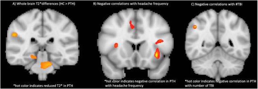 Fig. 2 (abstract AL030)