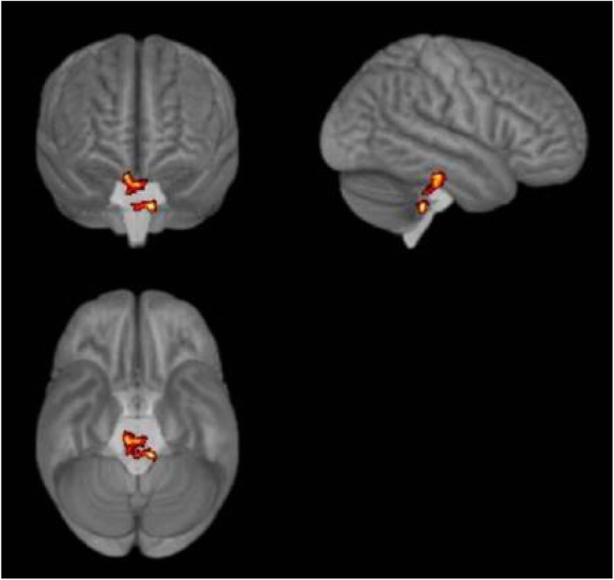 Fig. 2 (abstract P022).