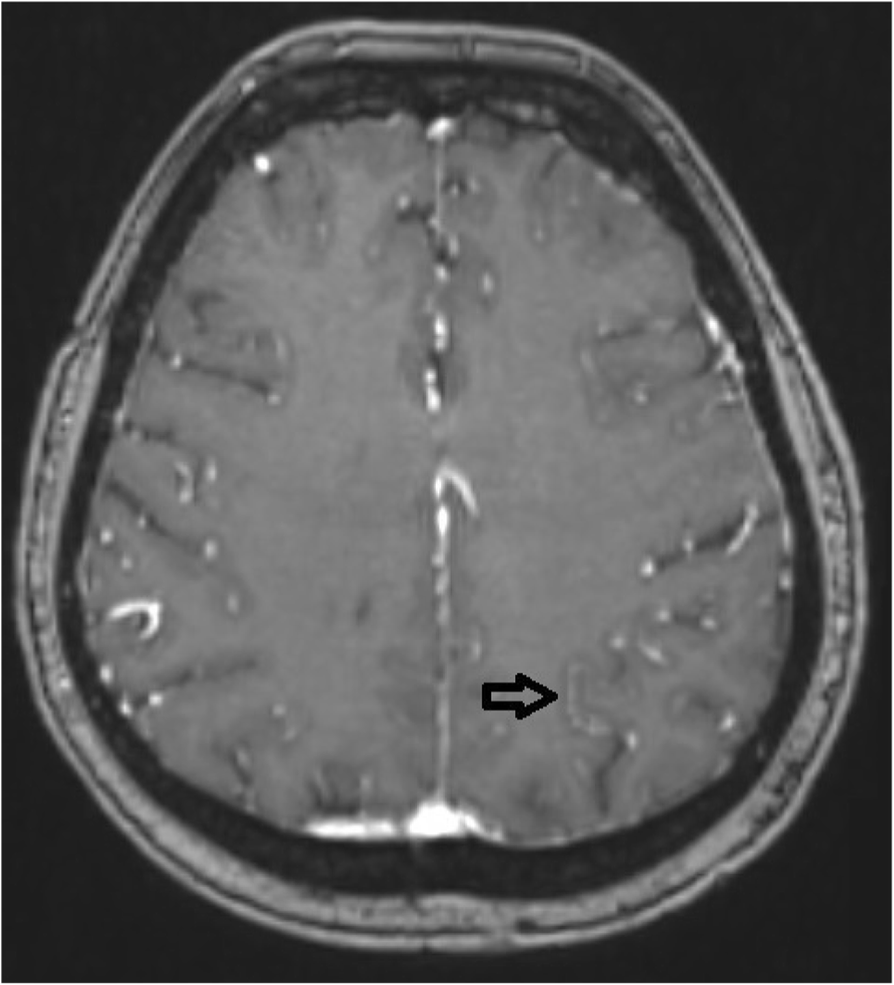 Fig. 2 (abstract P0123).