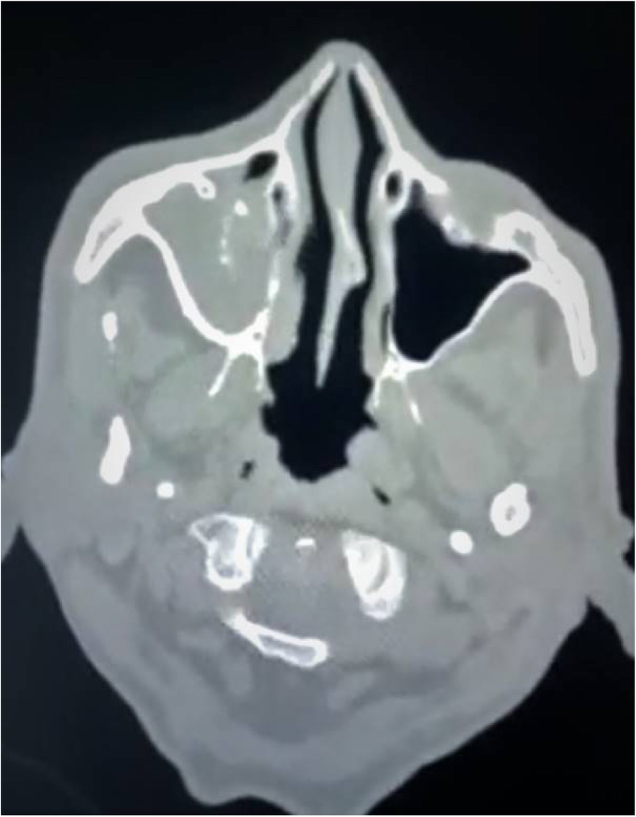 Fig. 2 (abstract P0424).