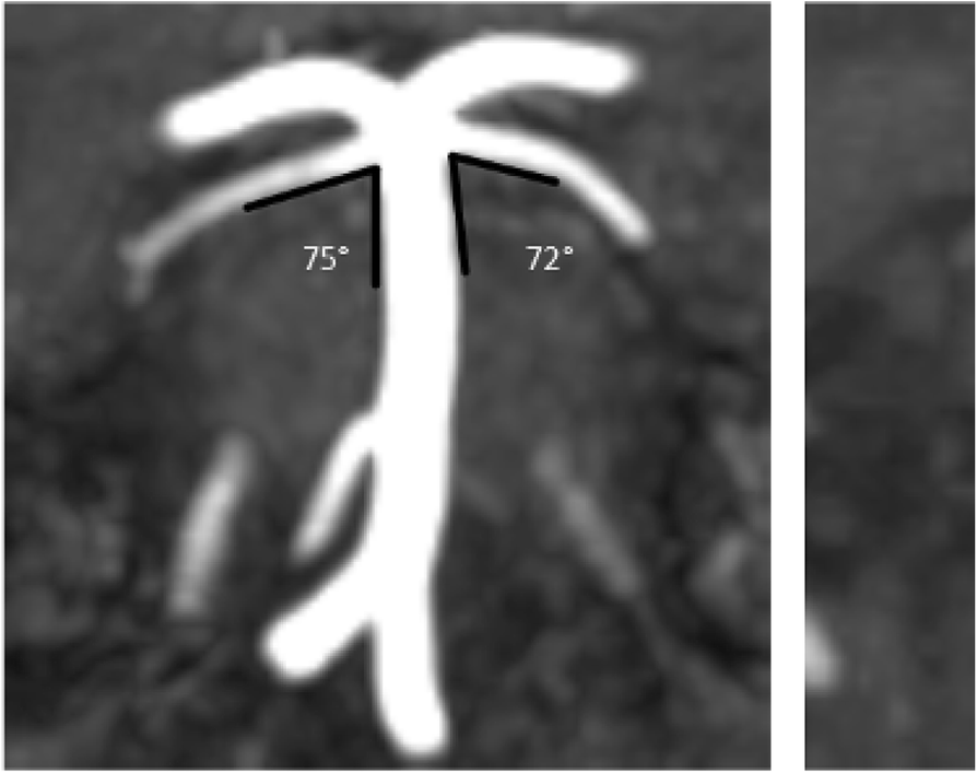 Fig. 1 (abstract P0446).